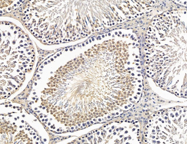 NOL9 Antibody in Immunohistochemistry (Paraffin) (IHC (P))