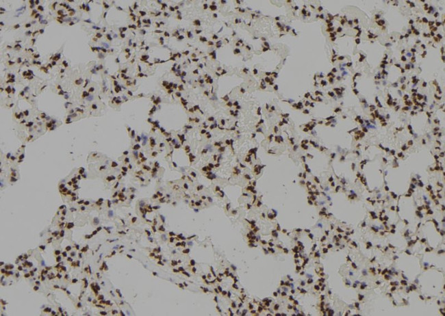 ZCCHC17 Antibody in Immunohistochemistry (Paraffin) (IHC (P))