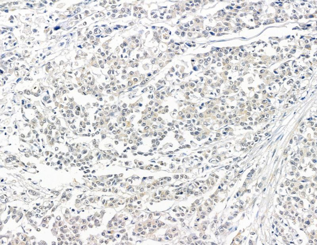 ZCCHC17 Antibody in Immunohistochemistry (Paraffin) (IHC (P))