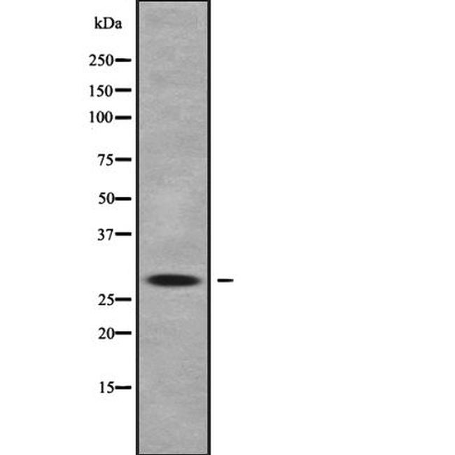 ZCCHC17 Antibody in Western Blot (WB)