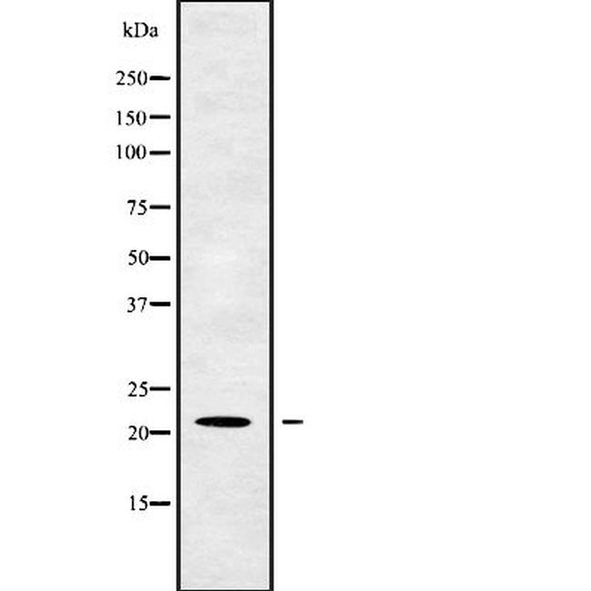 OAZ2 Antibody in Western Blot (WB)