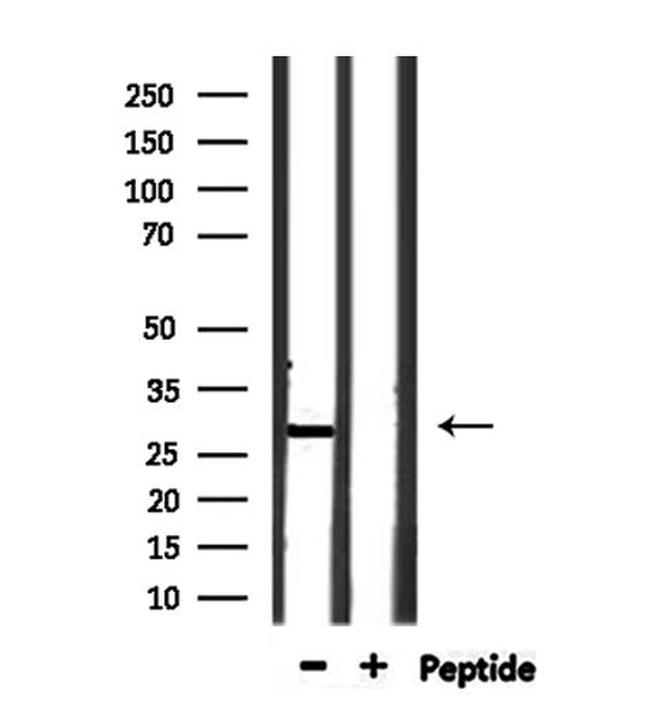 OAZ3 Antibody in Western Blot (WB)