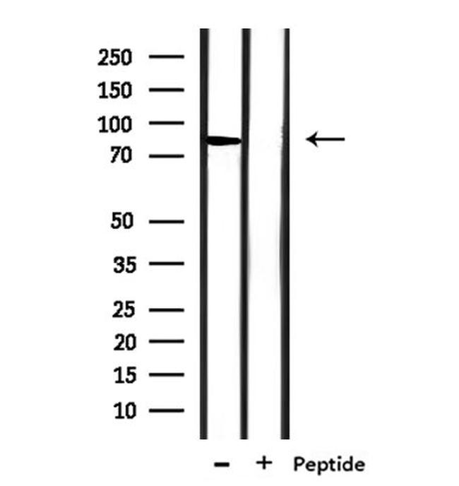 SLC6A17 Antibody in Western Blot (WB)