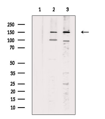 Palladin Antibody in Western Blot (WB)