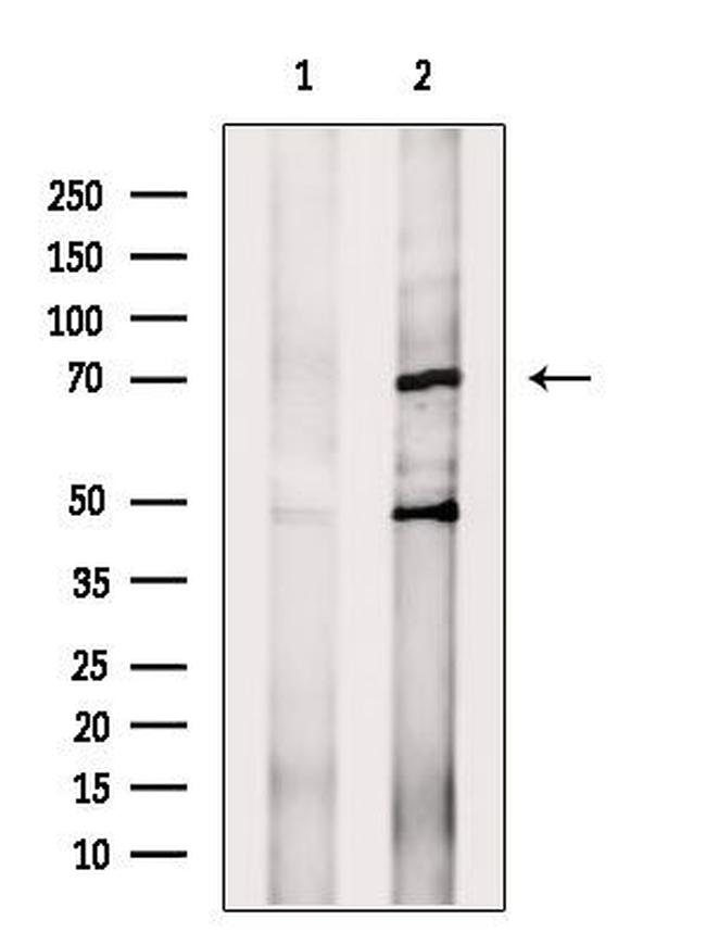 PEX5 Antibody in Western Blot (WB)