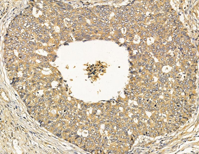 INPP5J Antibody in Immunohistochemistry (Paraffin) (IHC (P))