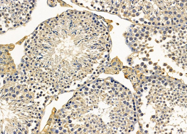 INPP5J Antibody in Immunohistochemistry (Paraffin) (IHC (P))