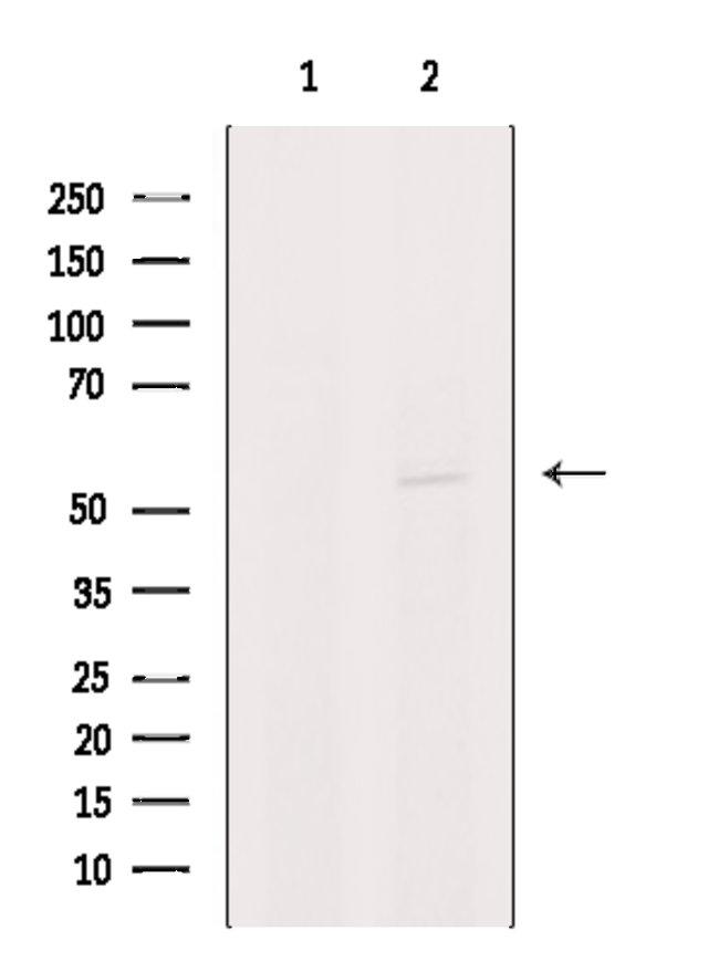 PIGA Antibody in Western Blot (WB)