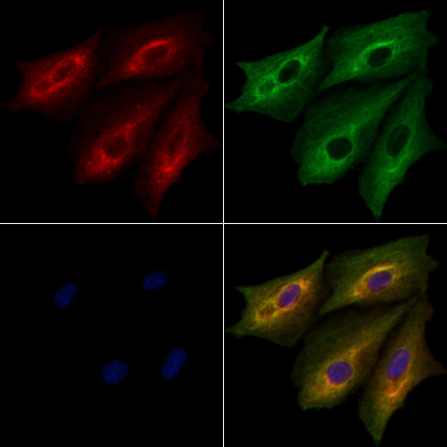 PITPN Antibody in Immunocytochemistry (ICC/IF)