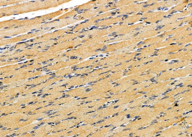 PIGW Antibody in Immunohistochemistry (Paraffin) (IHC (P))