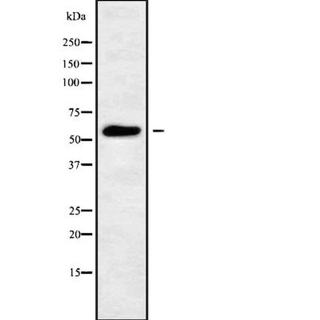 PIGW Antibody in Western Blot (WB)