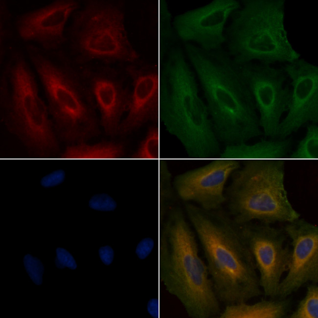 PIK3R6 Antibody in Immunocytochemistry (ICC/IF)