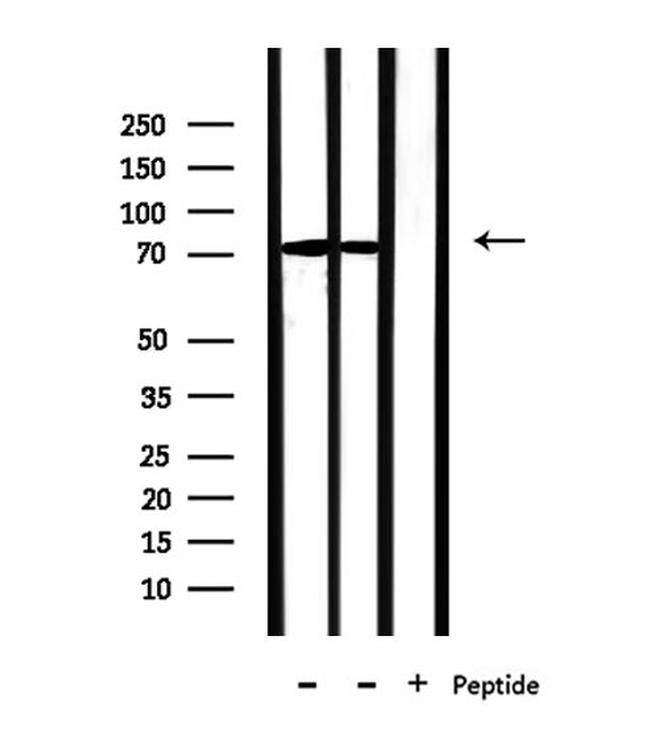 PABPC4 Antibody in Western Blot (WB)