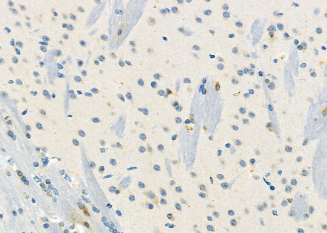 KCNE3 Antibody in Immunohistochemistry (Paraffin) (IHC (P))