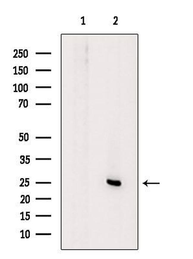 KCNE3 Antibody in Western Blot (WB)