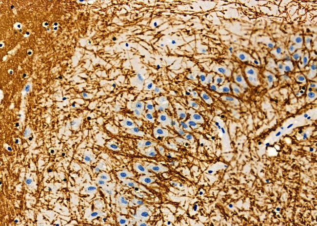 KCNG4 Antibody in Immunohistochemistry (Paraffin) (IHC (P))