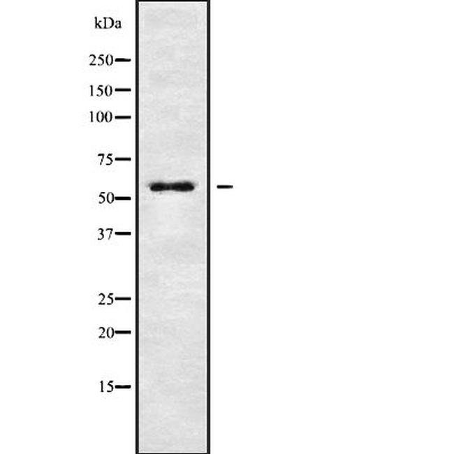 KCNG4 Antibody in Western Blot (WB)