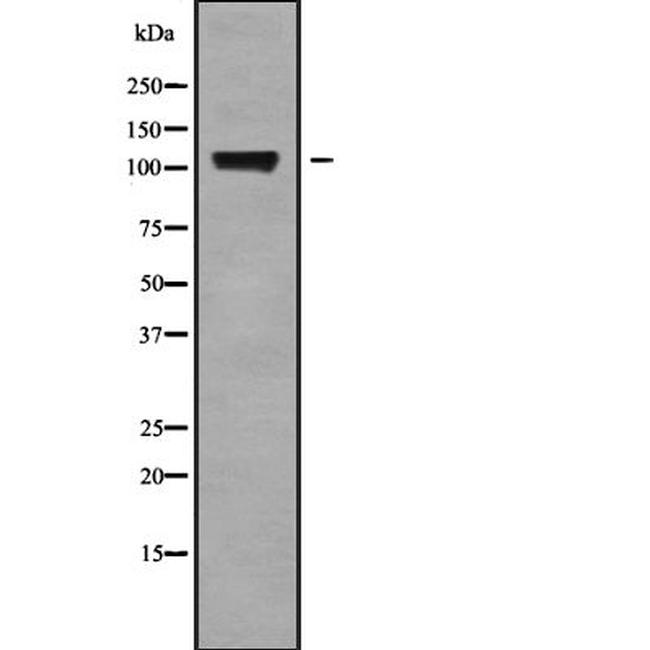 KCNH6 Antibody in Western Blot (WB)