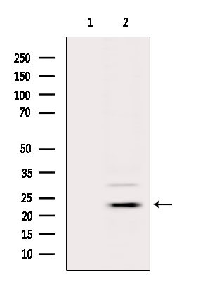 APOBEC3A/APOBEC3B Antibody in Western Blot (WB)
