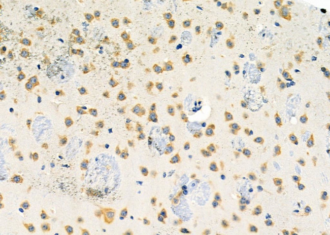 PPP1R1C Antibody in Immunohistochemistry (Paraffin) (IHC (P))