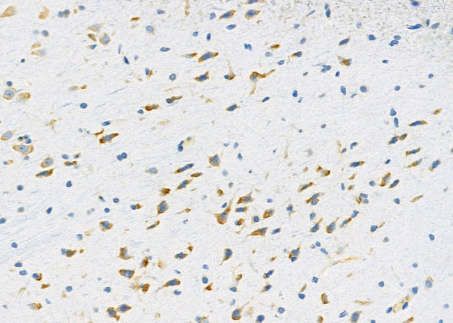 PPP1R1C Antibody in Immunohistochemistry (Paraffin) (IHC (P))