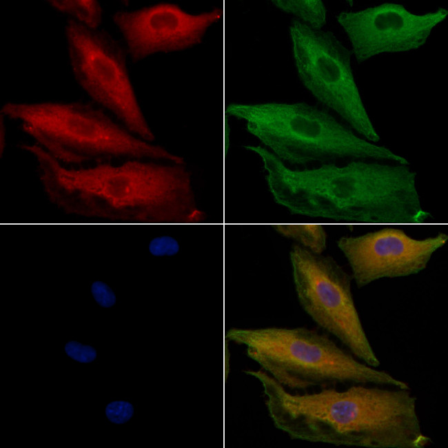 PPP1R3D Antibody in Immunocytochemistry (ICC/IF)