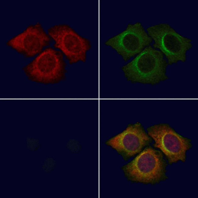 PPP1R3D Antibody in Immunocytochemistry (ICC/IF)