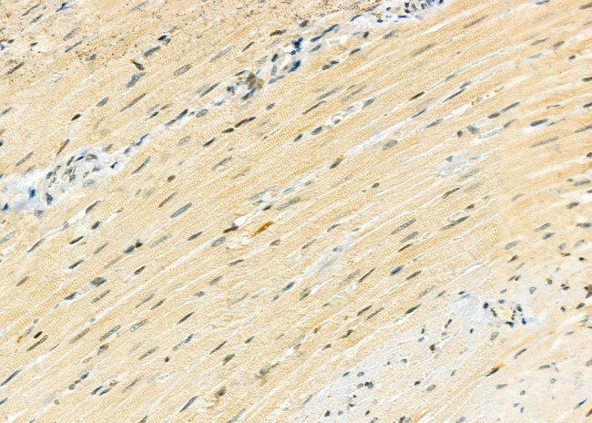 PPP1R3D Antibody in Immunohistochemistry (Paraffin) (IHC (P))