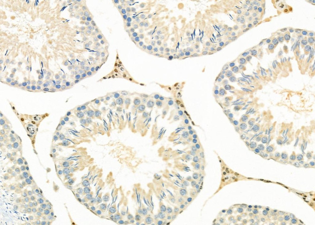 PPP1R3D Antibody in Immunohistochemistry (Paraffin) (IHC (P))