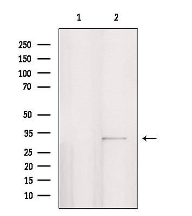 PPP1R3D Antibody in Western Blot (WB)