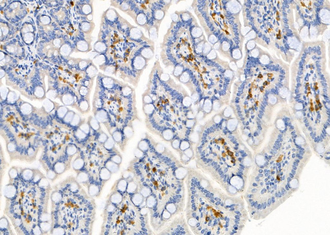 S100A7 Antibody in Immunohistochemistry (Paraffin) (IHC (P))