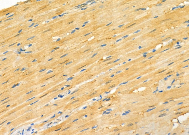 S100A7A Antibody in Immunohistochemistry (Paraffin) (IHC (P))