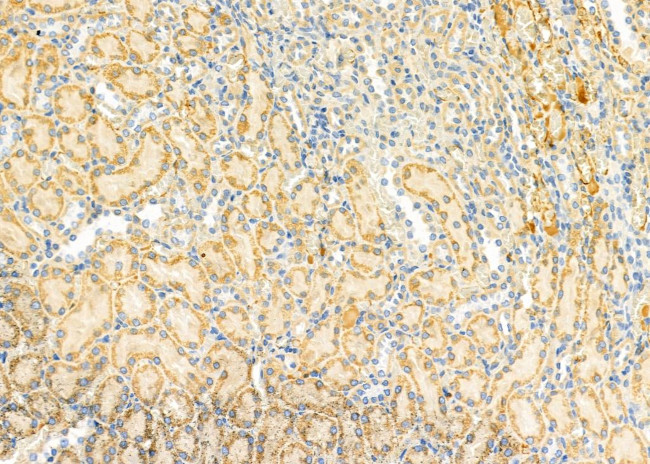 S100A7A Antibody in Immunohistochemistry (Paraffin) (IHC (P))