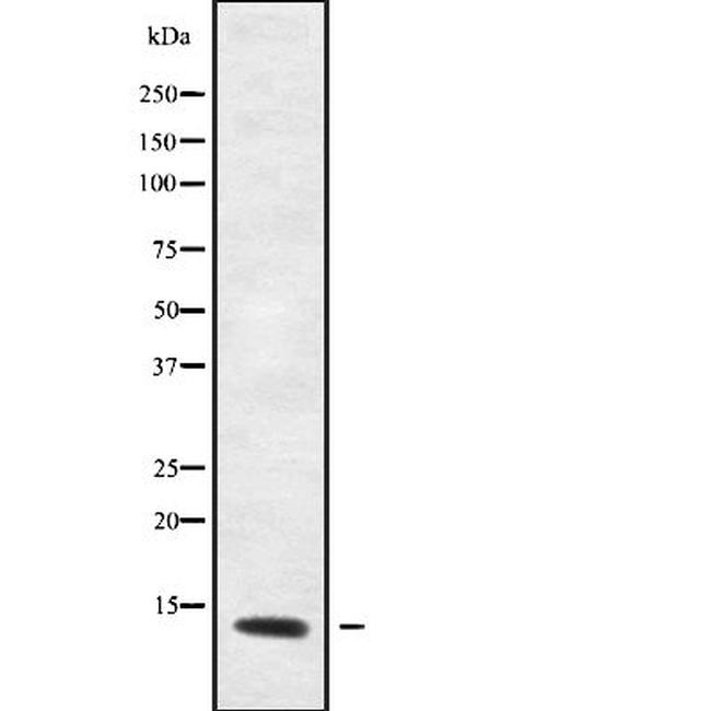 S100A7A Antibody in Western Blot (WB)