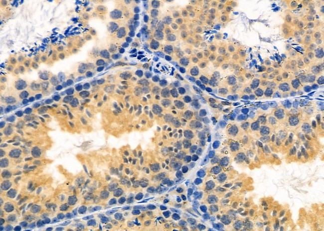 PAGE3 Antibody in Immunohistochemistry (Paraffin) (IHC (P))