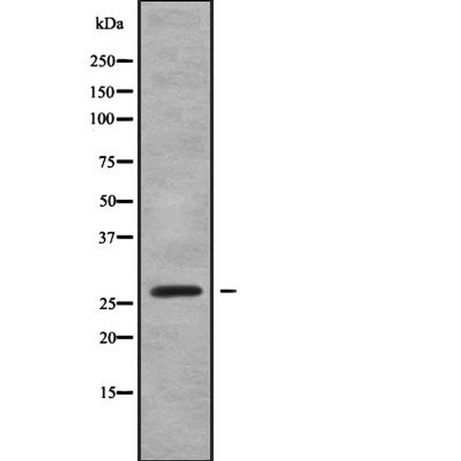 RABL2B Antibody in Western Blot (WB)