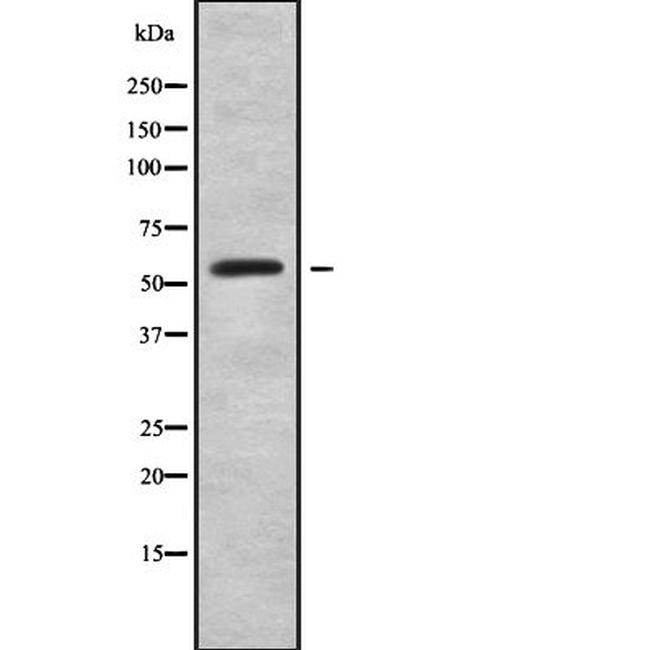 RFTN2 Antibody in Western Blot (WB)