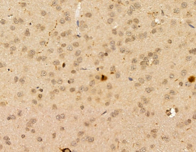 RGL1 Antibody in Immunohistochemistry (Paraffin) (IHC (P))