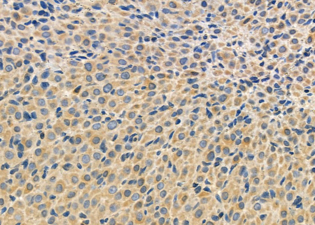 RASIP1 Antibody in Immunohistochemistry (Paraffin) (IHC (P))