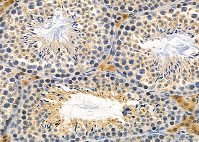 RAB15 Antibody in Immunohistochemistry (Paraffin) (IHC (P))