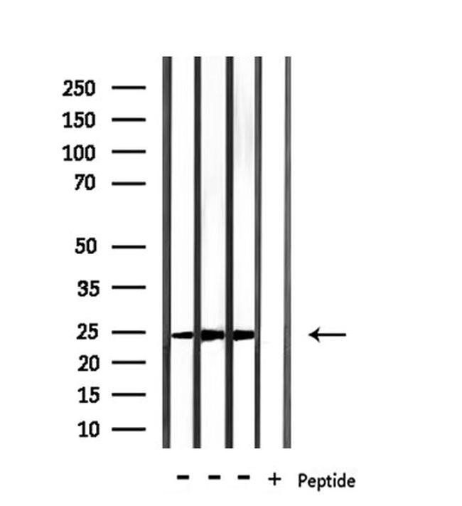 RAB15 Antibody in Western Blot (WB)