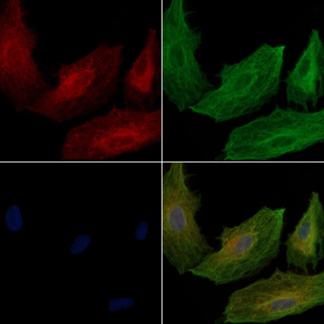 RAB1A Antibody in Immunocytochemistry (ICC/IF)