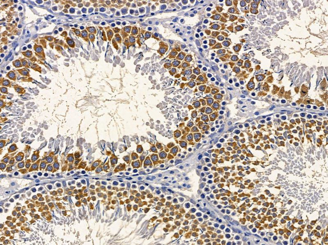 RAB1A Antibody in Immunohistochemistry (Paraffin) (IHC (P))