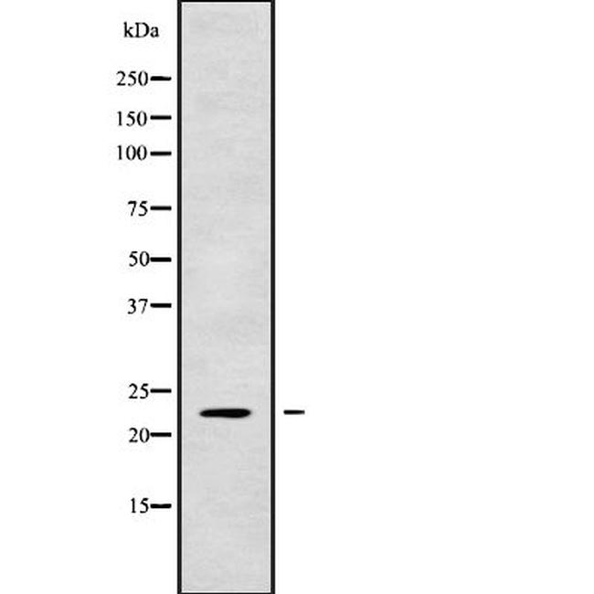 RAB1A Antibody in Western Blot (WB)