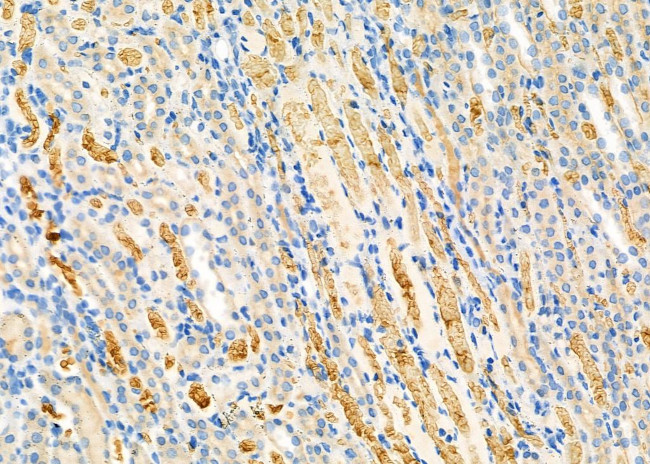 RAB1B Antibody in Immunohistochemistry (Paraffin) (IHC (P))