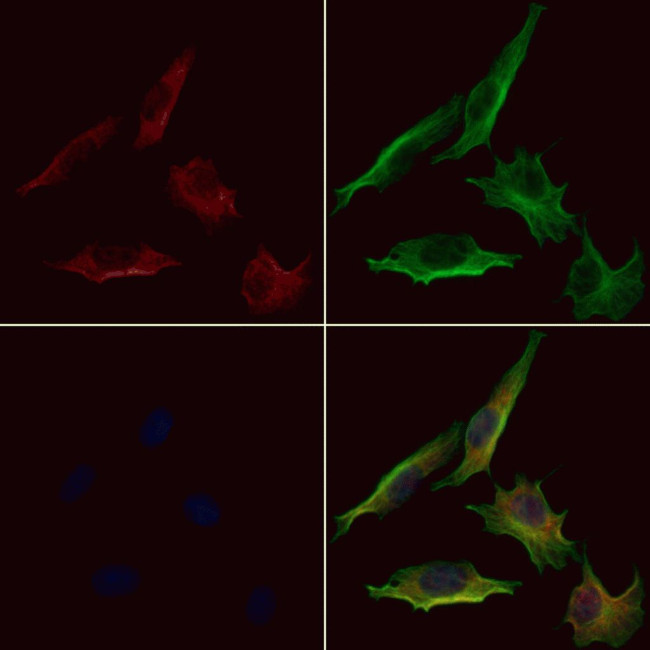 RAB24 Antibody in Immunocytochemistry (ICC/IF)