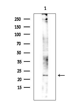 RAB24 Antibody in Western Blot (WB)