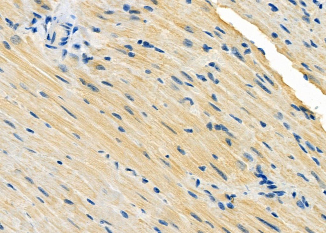 RAB28 Antibody in Immunohistochemistry (Paraffin) (IHC (P))