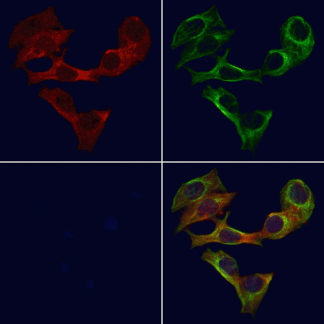 RAB30 Antibody in Immunocytochemistry (ICC/IF)