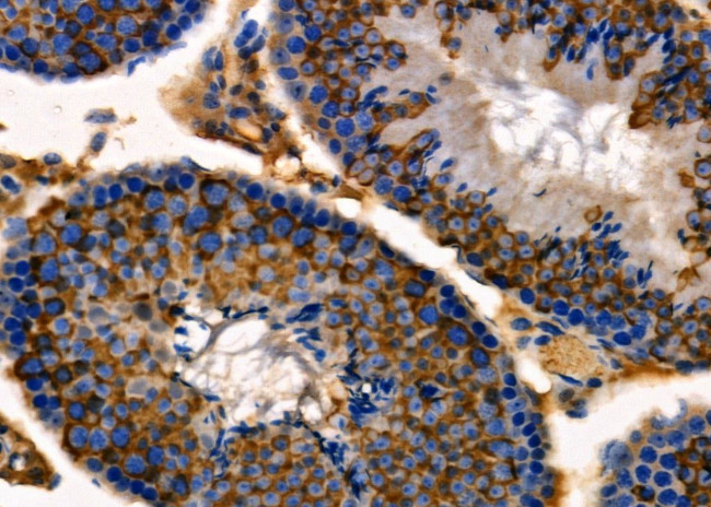 RAB30 Antibody in Immunohistochemistry (Paraffin) (IHC (P))